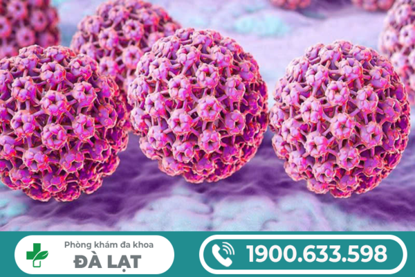 Hình ảnh minh họa